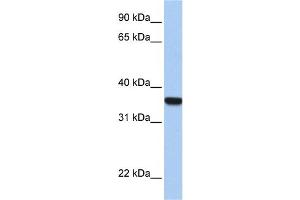 WB Suggested Anti-HOXD1 Antibody Titration:  0. (HOXD1 anticorps  (C-Term))