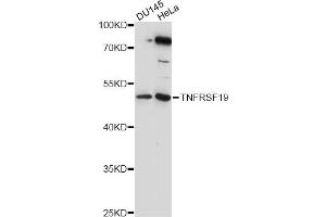 Western blot analysis of extracts of various cell lines, using TNFRSF19 antibody (ABIN6290995) at 1:1000 dilution. (TNFRSF19 anticorps)