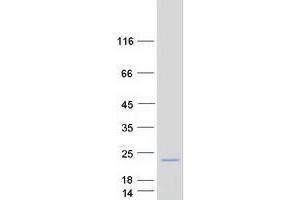 Validation with Western Blot