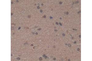IHC-P analysis of Human Tissue, with DAB staining. (SPTBN4 anticorps  (AA 64-285))