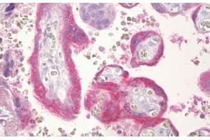 Anti-CGB / hCG Beta antibody IHC staining of human placenta, trophoblast. (CGB anticorps  (AA 101-150))