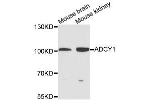 Western blot analysis of extracts of various cell lines, using ADCY1 antibody (ABIN5996345) at 1/1000 dilution. (ADCY1 anticorps)