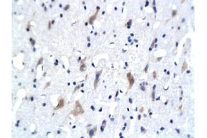 Formalin-fixed and paraffin embedded rat brain labeled with Anti- 5-HTR3Polyclonal Antibody, Unconjugated (ABIN677813) followed by conjugation to the secondary antibody and DAB staining (Serotonin Receptor 3A anticorps  (AA 301-400))