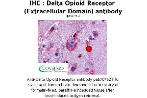 Image no. 1 for anti-Opioid Receptor, delta 1 (OPRD1) (3rd Extracellular Domain) antibody (ABIN1733580) (OPRD1 anticorps  (3rd Extracellular Domain))