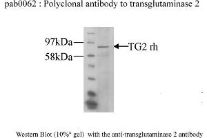 Image no. 1 for anti-Transglutaminase 2 (C Polypeptide, Protein-Glutamine-gamma-Glutamyltransferase) (TGM2) antibody (ABIN347018) (Transglutaminase 2 anticorps)