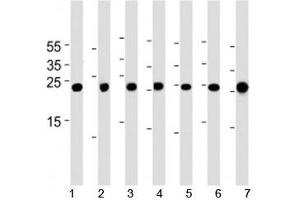 Cebpd antibody western blot analysis in 1) A549, 2) HeLa, 3) NCI-H460, 4) U-937, 5) mouse NIH3T3 cell line, rat 6) lung and 7) testis tissue lysate. (CEBPD anticorps  (AA 161-189))