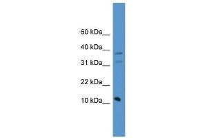 PSENEN antibody used at 0. (PEN2 anticorps  (C-Term))