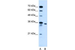 WB Suggested Anti-SLC25A32 Antibody Titration:  0. (SLC25A32 anticorps  (N-Term))