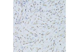 Immunohistochemistry of paraffin-embedded human endometrium using TARDBP Antibody.