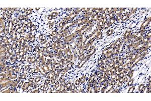 Detection of LY96 in Mouse Kidney Tissue using Polyclonal Antibody to Lymphocyte Antigen 96 (LY96) (LY96 anticorps  (AA 19-130))