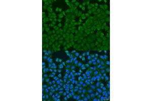 Immunofluorescence analysis of U2OS cells using IL27RA antibody. (IL27 Receptor alpha anticorps  (AA 33-283))
