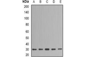Western blot analysis of IMPA1 expression in SKOV3 (A), Jurkat (B), mouse liver (C), mouse brain (D), rat thymus (E) whole cell lysates.
