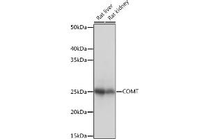 Western blot analysis of extracts of various cell lines, using COMT Rabbit mAb (ABIN1682443, ABIN3018925, ABIN3018926 and ABIN7101689) at 1:1000 dilution.