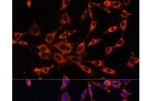 Immunofluorescence analysis of NIH-3T3 cells using ITPR3 Polyclonal Antibody at dilution of 1:100.