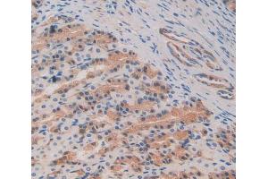 Used in DAB staining on fromalin fixed paraffin- embedded stomach tissue