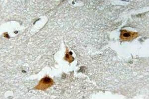 Immunohistochemistry (IHC) analyzes of p-AFX1 in paraffin-embedded human brain tissue. (FOXO4 anticorps  (pSer197))