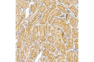 Immunohistochemistry of paraffin-embedded mouse kidney using CLIC4 Rabbit pAb (ABIN6127638, ABIN6138723, ABIN6138724 and ABIN6222890) at dilution of 1:50 (40x lens).