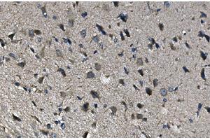 IHC analysis of ADRA1A using anti-ADRA1A antibody (ABIN3043732). (alpha 1 Adrenergic Receptor anticorps  (C-Term))