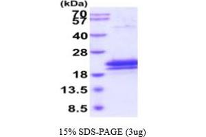 SDS-PAGE (SDS) image for Interleukin 17B (IL17B) (AA 21-180) protein (His tag) (ABIN6387979)