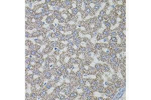 Immunohistochemistry of paraffin-embedded rat liver using MAP3K5 antibody (ABIN1873618) (40x lens).