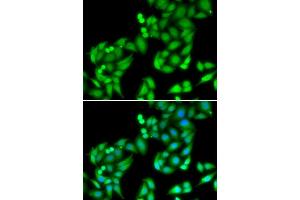 Immunofluorescence analysis of MCF7 cells using COPS3 antibody. (COPS3 anticorps  (AA 194-423))