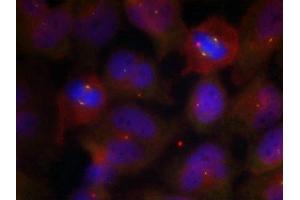 Immunofluorescence staining of methanol-fixed Hela cells using Synaptotagmin 1/2 (Phospho-Thr202/199) Antibody. (SYT1/SYT2 (pThr199), (pThr202) anticorps)