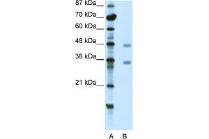 WB Suggested Anti-CBX8 Antibody Titration:  2. (CBX8 anticorps  (C-Term))