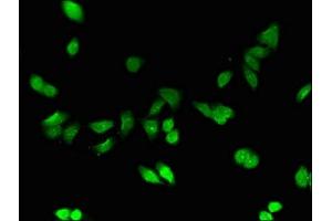 Immunofluorescent analysis of HepG2 cells using ABIN7159517 at dilution of 1:100 (MT1E anticorps  (AA 4-59))