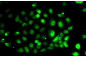 Immunofluorescence analysis of MCF7 cells using PPP2R1B Polyclonal Antibody (PPP2R1B anticorps)