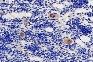 Immunohistochemistry analysis of paraffin-embedded rat bone using,TMEM177 (ABIN7075996) at dilution of 1: 1000 (TMEM177 anticorps)