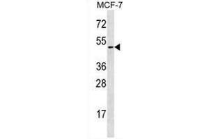 Western blot analysis in MCF-7 cell line lysates (35ug/lane) using Ladinin-1  Antibody (N-term). (Ladinin 1 anticorps  (N-Term))