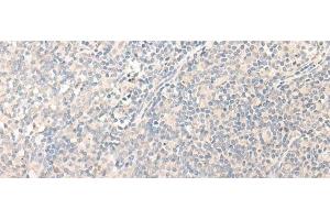 Immunohistochemistry of paraffin-embedded Human tonsil tissue using RADIL Polyclonal Antibody at dilution of 1:40(x200) (Radil anticorps)