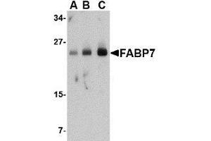 Western blot analysis of FABP7 in human breast tissue lysate with AP30326PU-N FABP7 antibody at (A) 0. (FABP7 anticorps  (Center))