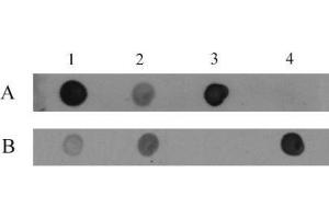 5-Hydroxymethylcytosine (5-hmC, 5-hydroxymethylcytidine) antibody tested by dot blot analysis. (5-Hydroxymethylcytosine anticorps)