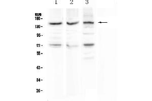 Western blot analysis of CD163 using anti-CD163 antibody . (CD163 anticorps  (AA 47-201))