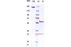 Anti-CXCL12 / SDF1a Reference Antibody (Genentech anti-CXCL12) on SDS-PAGE under reducing (R) condition.