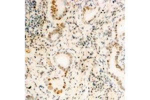 Immunohistochemical analysis of FUBP3 staining in human kidney formalin fixed paraffin embedded tissue section. (FUBP3 anticorps)