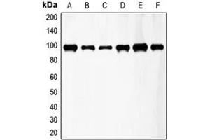 Western blot analysis of FGFR3 expression in HeLa (A), A549 (B), T47D (C), mouse kidney (D), mouse heart (E), rat lung (F) whole cell lysates. (FGFR3 anticorps  (Center))