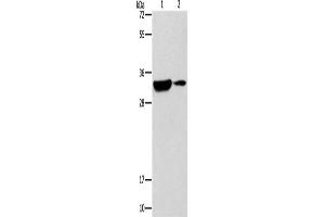 Western Blotting (WB) image for anti-Regulator of Calcineurin 1 (RCAN1) antibody (ABIN2432541) (RCAN1 anticorps)