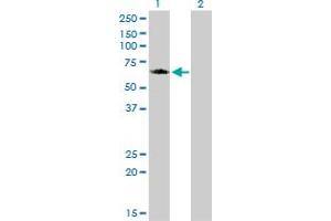 Western Blot analysis of GGA1 expression in transfected 293T cell line by GGA1 monoclonal antibody (M02), clone 1G8.