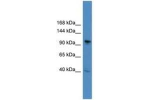 Image no. 1 for anti-B-Cell CLL/lymphoma 11B (Zinc Finger Protein) (BCL11B) (C-Term) antibody (ABIN6745310) (BCL11B anticorps  (C-Term))