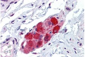 Human Small Intestine, submucosal plexus: Formalin-Fixed, Paraffin-Embedded (FFPE)