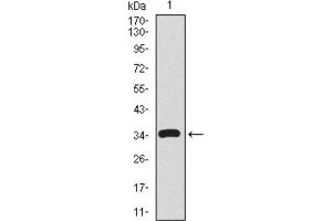 Western blot analysis using CD59 antibody against human CD59 recombinant protein. (CD59 anticorps  (AA 31-111))