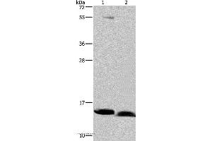 Western blot analysis of Human bladder carcinoma and fetal brain tissue, using NDUFA5 Polyclonal Antibody at dilution of 1:400 (NDUFA5 anticorps)