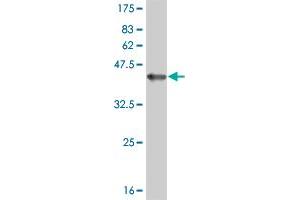 Western Blot detection against Immunogen (36. (ERN1 anticorps  (AA 401-500))