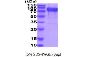 SDS-PAGE (SDS) image for CD96 (CD96) (AA 22-503) protein (His tag) (ABIN5854929)