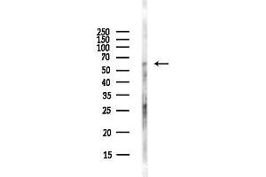 anti-Keratin 6 (KRT6) (C-Term) antibody