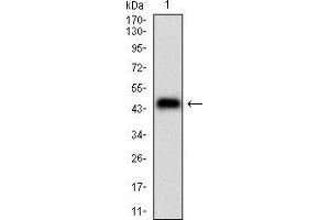 Western blot analysis using PLA2G12A mAb against human PLA2G12A (AA: 21-189) recombinant protein.