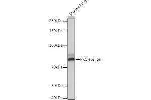 Western blot analysis of extracts of Mouse lung, using PKC epsilon Rabbit mAb (ABIN7269636) at 1:1000 dilution.