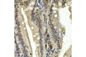 Immunohistochemistry of paraffin-embedded rat Intestine using RBBP5 antibody (ABIN5974189) at dilution of 1/100 (40x lens). (RBBP5 anticorps)